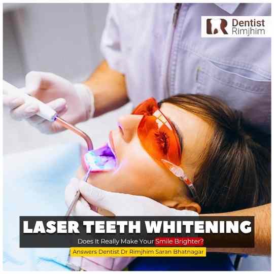 Laser Teeth Whitening: Does It Really Make Your Smile Brighter?