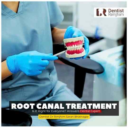 Single Sitting Root Canal Treatment: Is It Right for Everyone? Answers Dental Expert