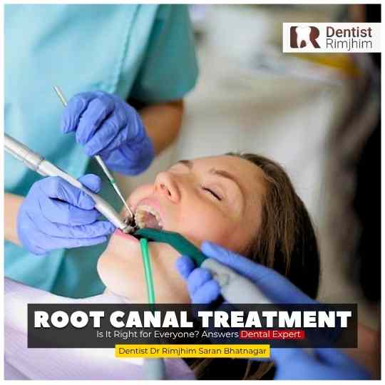 Single Sitting Root Canal Treatment: Is It Right for Everyone? Answers Dental Expert