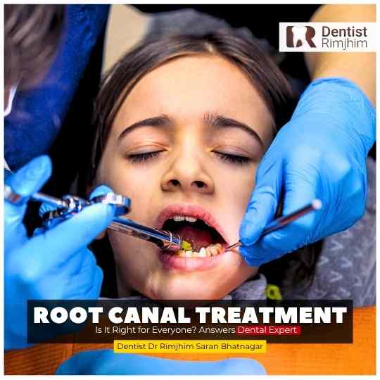 Single Sitting Root Canal Treatment: Is It Right for Everyone? Answers Dental Expert