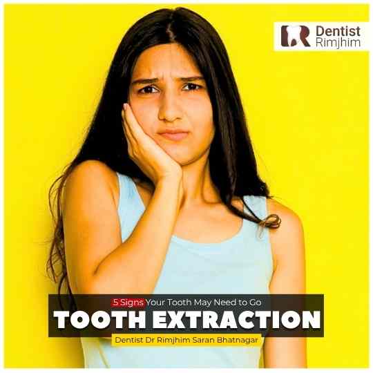 Do You Really Need a Tooth Extraction? 5 Signs Your Tooth May Need to Go