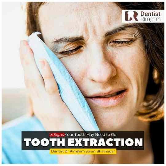 Do You Really Need a Tooth Extraction? 5 Signs Your Tooth May Need to Go