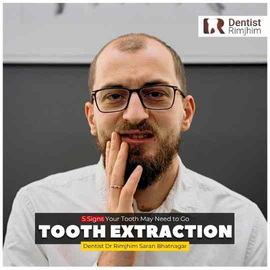 Do You Really Need a Tooth Extraction? 5 Signs Your Tooth May Need to Go