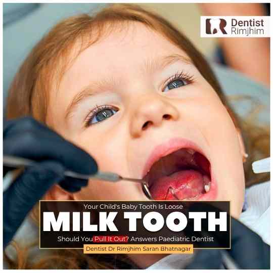 Your Child's Baby Tooth Is Loose—Should You Pull It Out? Answers Paediatric Dentist
