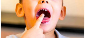 Your Child’s Baby Tooth Is Loose—Should You Pull It Out? Answers Paediatric Dentist