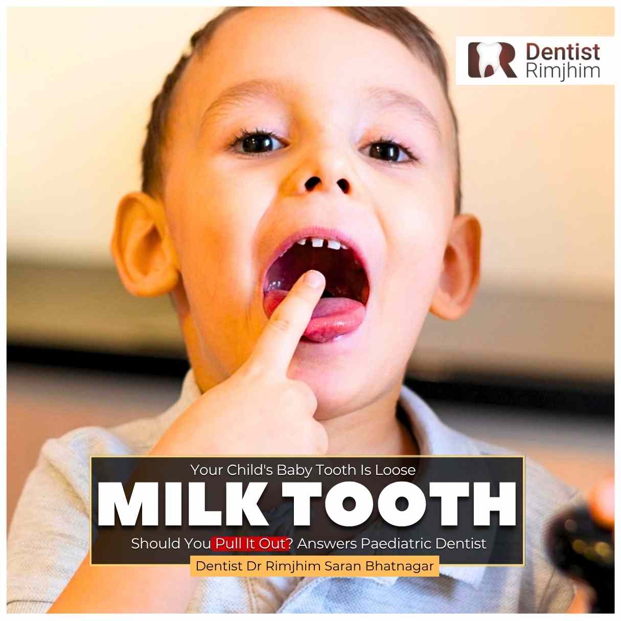 Your Child’s Baby Tooth Is Loose—Should You Pull It Out? Answers Paediatric Dentist